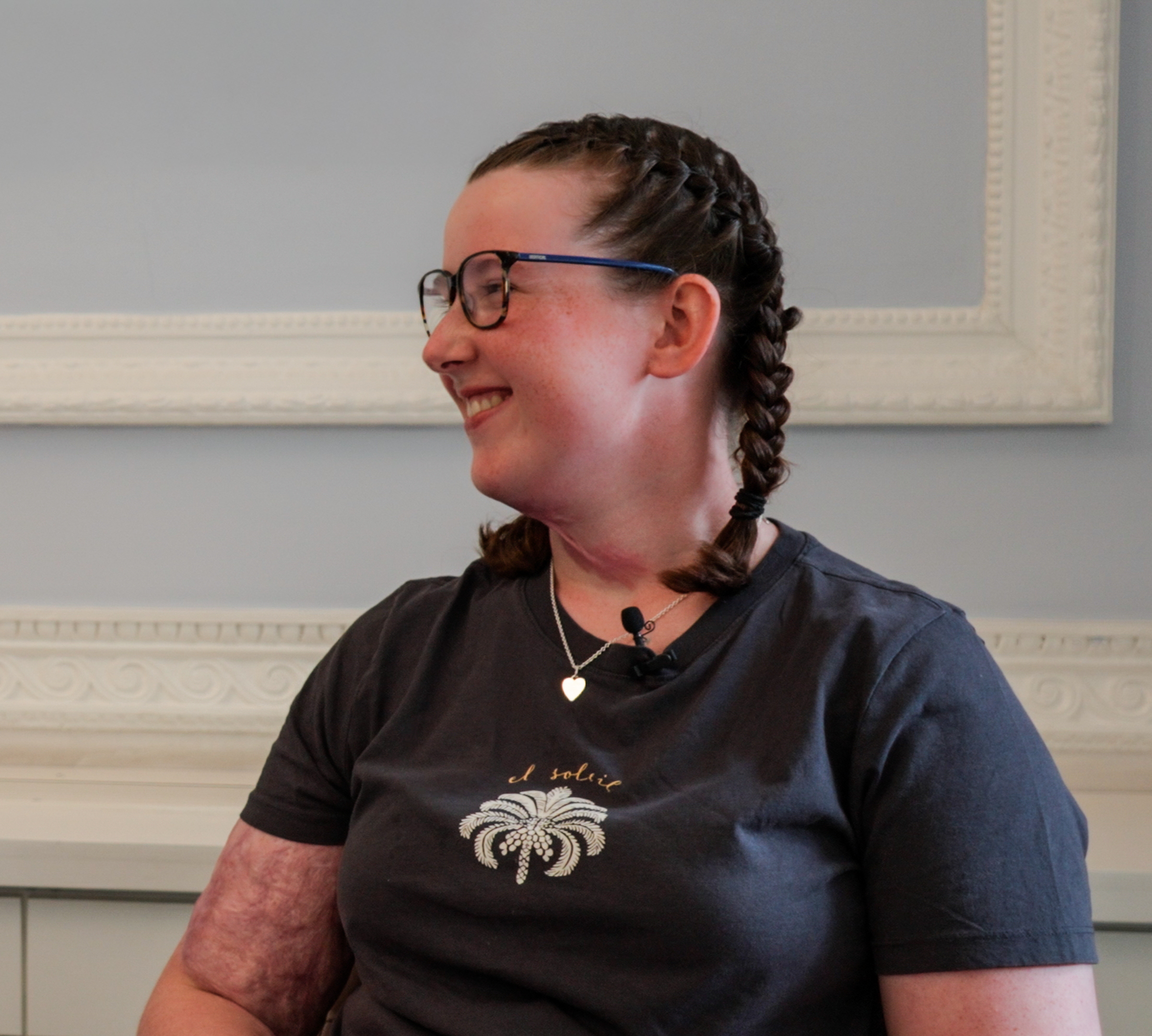 Hollie Burns Survivor Image