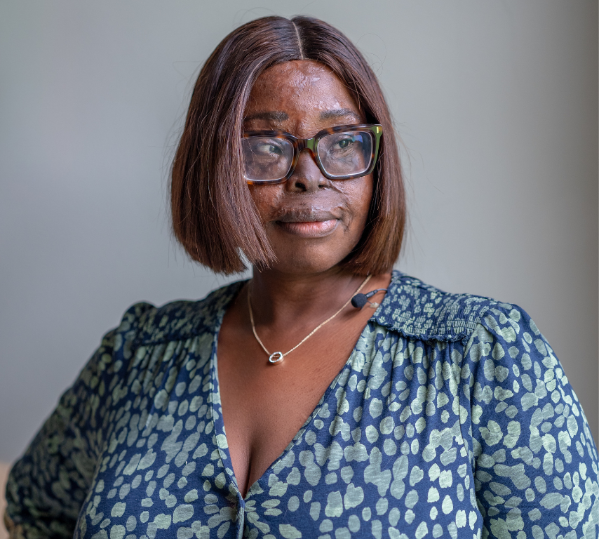 Judith burns survivor image